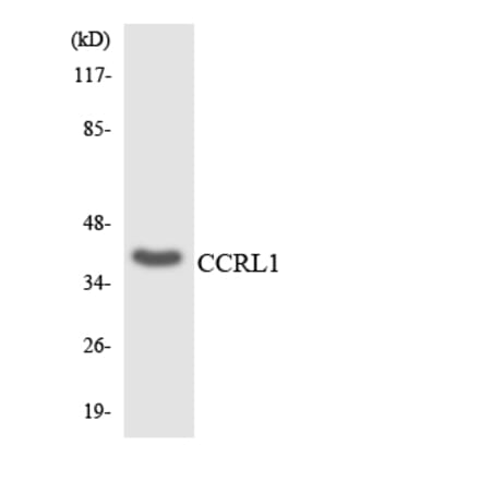 Western Blot - Anti-CCRL1 Antibody (R12-2580) - Antibodies.com