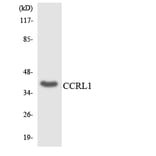 Western Blot - Anti-CCRL1 Antibody (R12-2580) - Antibodies.com
