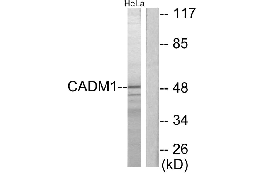 Western Blot - Anti-CADM1 Antibody (C12108) - Antibodies.com