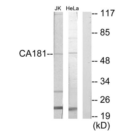 Western Blot - Anti-CA181 Antibody (C19639) - Antibodies.com