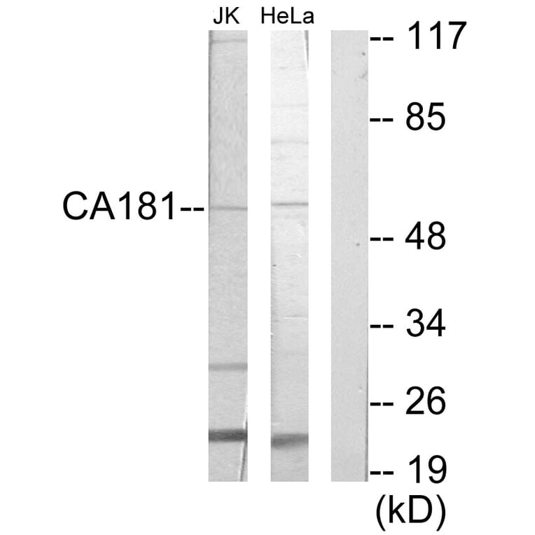 Western Blot - Anti-CA181 Antibody (C19639) - Antibodies.com
