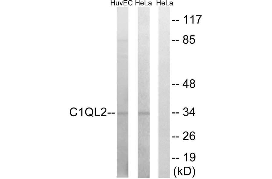 Western Blot - Anti-C1QL2 Antibody (C15207) - Antibodies.com