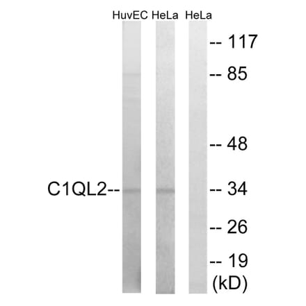 Western Blot - Anti-C1QL2 Antibody (C15207) - Antibodies.com