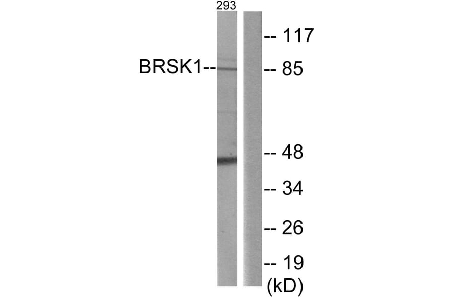 Western Blot - Anti-BRSK1 Antibody (C11392) - Antibodies.com