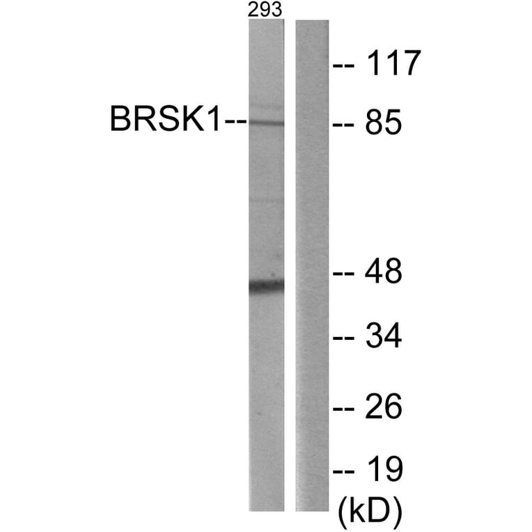 Western Blot - Anti-BRSK1 Antibody (C11392) - Antibodies.com