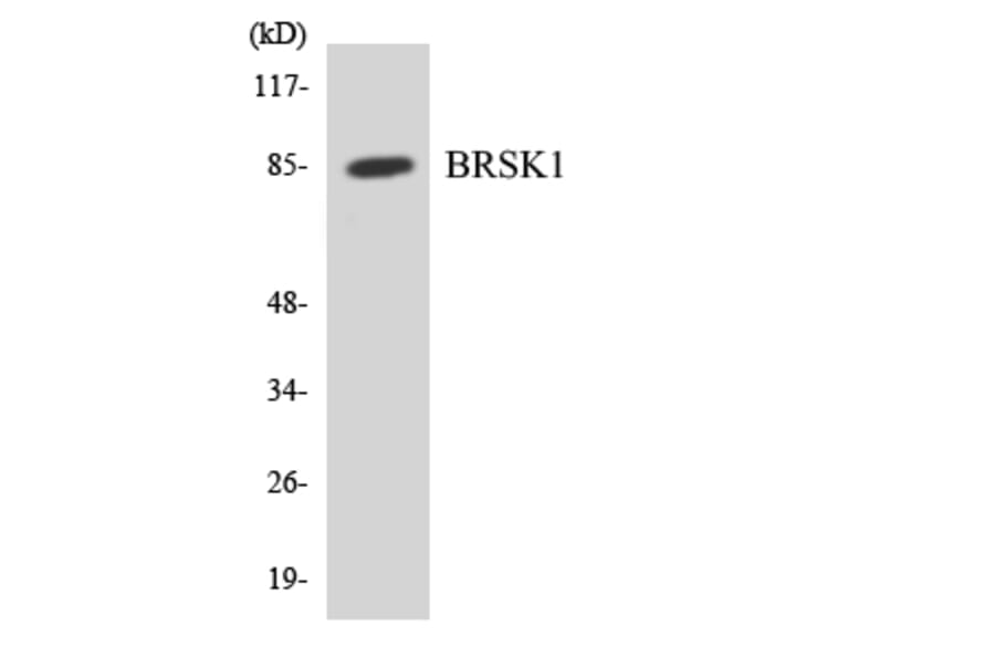 Western Blot - Anti-BRSK1 Antibody (R12-2548) - Antibodies.com