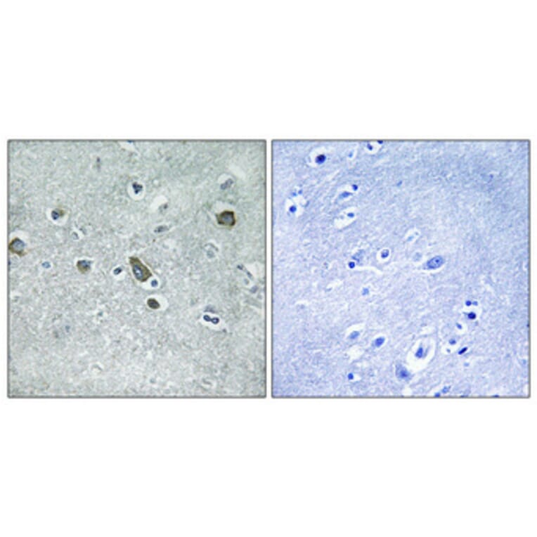 Immunohistochemistry - Anti-BORG3 Antibody (C15026) - Antibodies.com