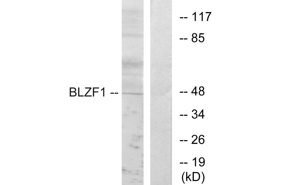 Western Blot - Anti-BLZF1 Antibody (C11683) - Antibodies.com