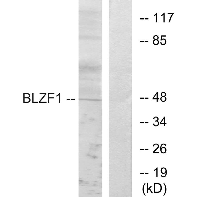 Western Blot - Anti-BLZF1 Antibody (C11683) - Antibodies.com