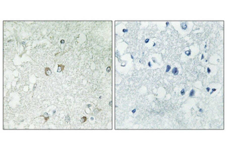 Immunohistochemistry - Anti-BLZF1 Antibody (C11683) - Antibodies.com