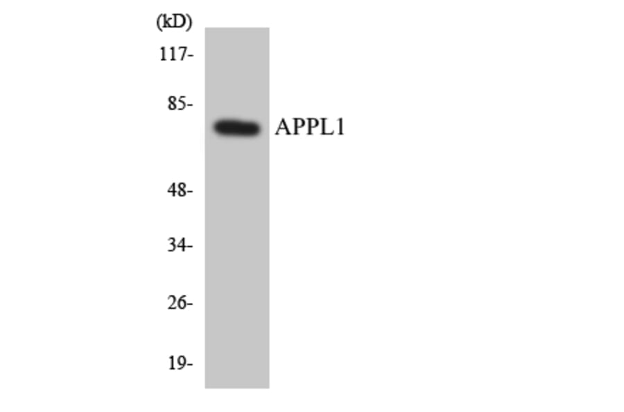 Western Blot - Anti-APPL1 Antibody (R12-2498) - Antibodies.com
