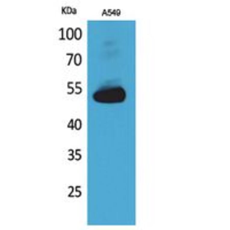 Western Blot - Anti-ANXA7 Antibody (C30151) - Antibodies.com