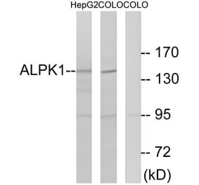 Western Blot - Anti-ALPK1 Antibody (C11534) - Antibodies.com