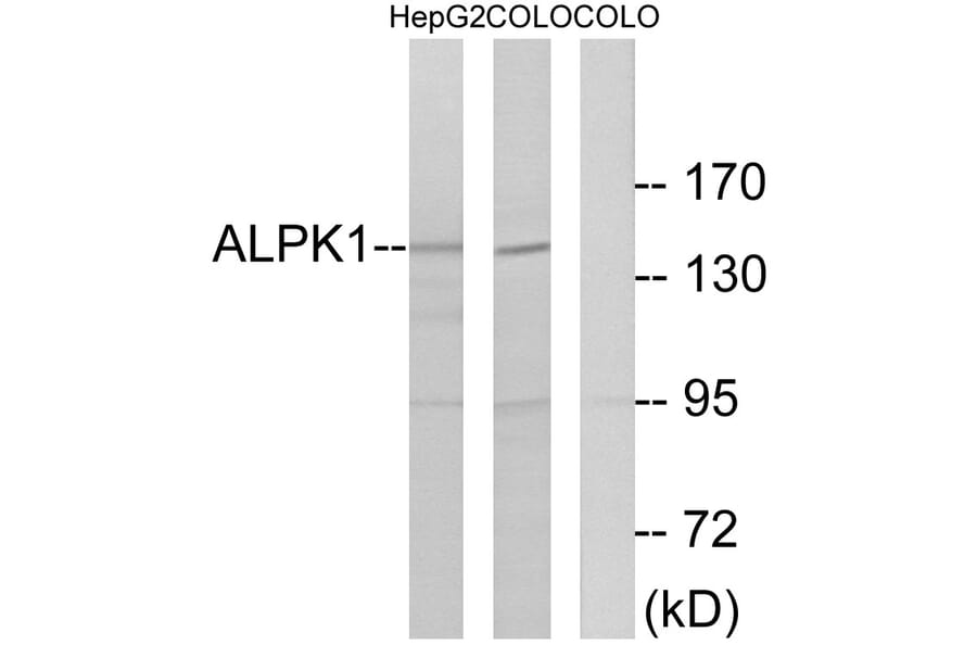 Western Blot - Anti-ALPK1 Antibody (C11534) - Antibodies.com