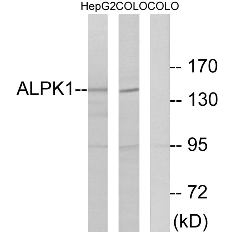 Western Blot - Anti-ALPK1 Antibody (C11534) - Antibodies.com