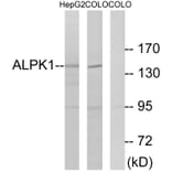 Western Blot - Anti-ALPK1 Antibody (C11534) - Antibodies.com