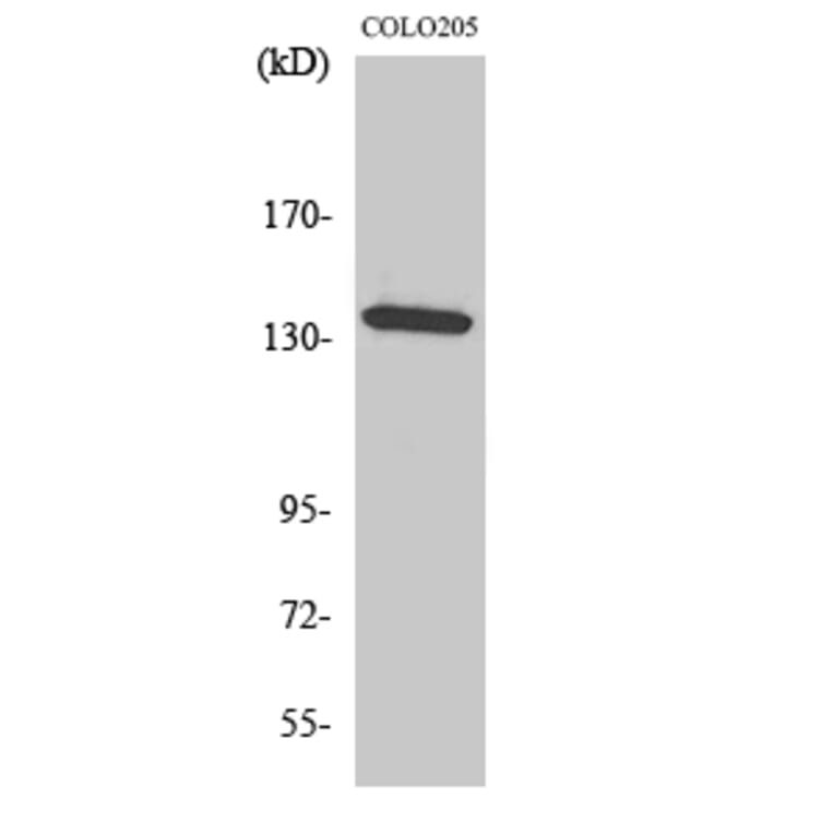 Western Blot - Anti-ALPK1 Antibody (C11534) - Antibodies.com