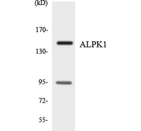 Western Blot - Anti-ALPK1 Antibody (R12-2478) - Antibodies.com
