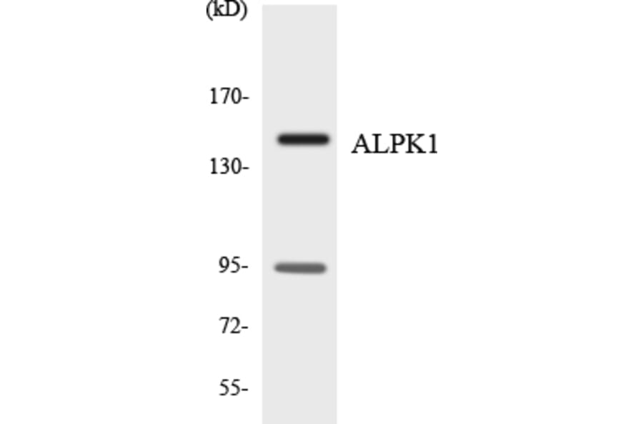 Western Blot - Anti-ALPK1 Antibody (R12-2478) - Antibodies.com