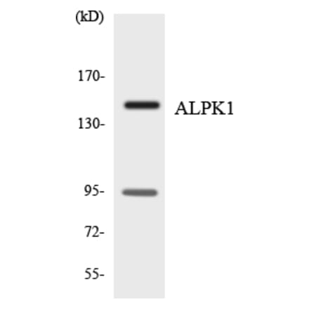 Western Blot - Anti-ALPK1 Antibody (R12-2478) - Antibodies.com