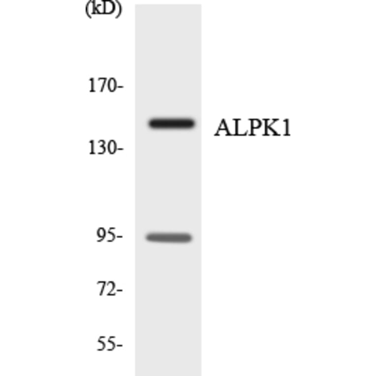 Western Blot - Anti-ALPK1 Antibody (R12-2478) - Antibodies.com
