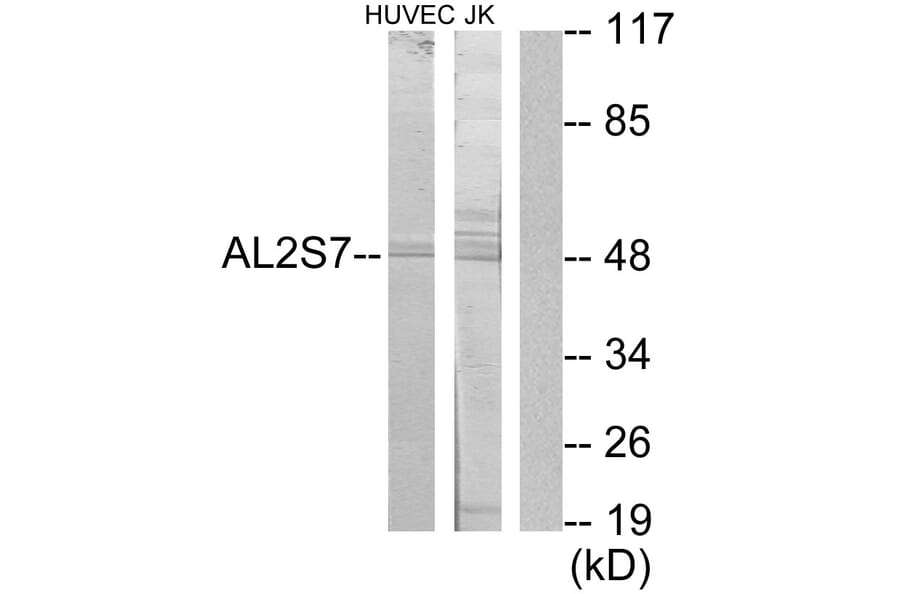 Western Blot - Anti-AL2S7 Antibody (C11529) - Antibodies.com