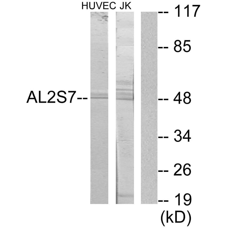 Western Blot - Anti-AL2S7 Antibody (C11529) - Antibodies.com