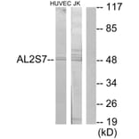 Western Blot - Anti-AL2S7 Antibody (C11529) - Antibodies.com