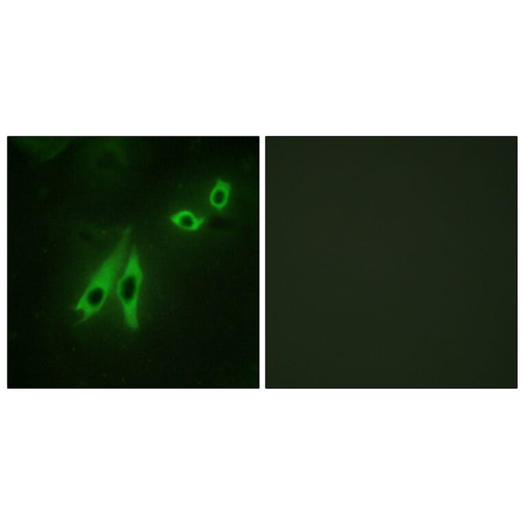 Immunofluorescence - Anti-AKAP3 Antibody (C10200) - Antibodies.com