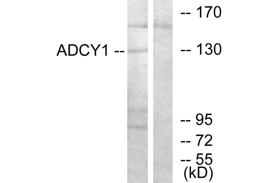 Western Blot - Anti-ADCY1 Antibody (C12031) - Antibodies.com
