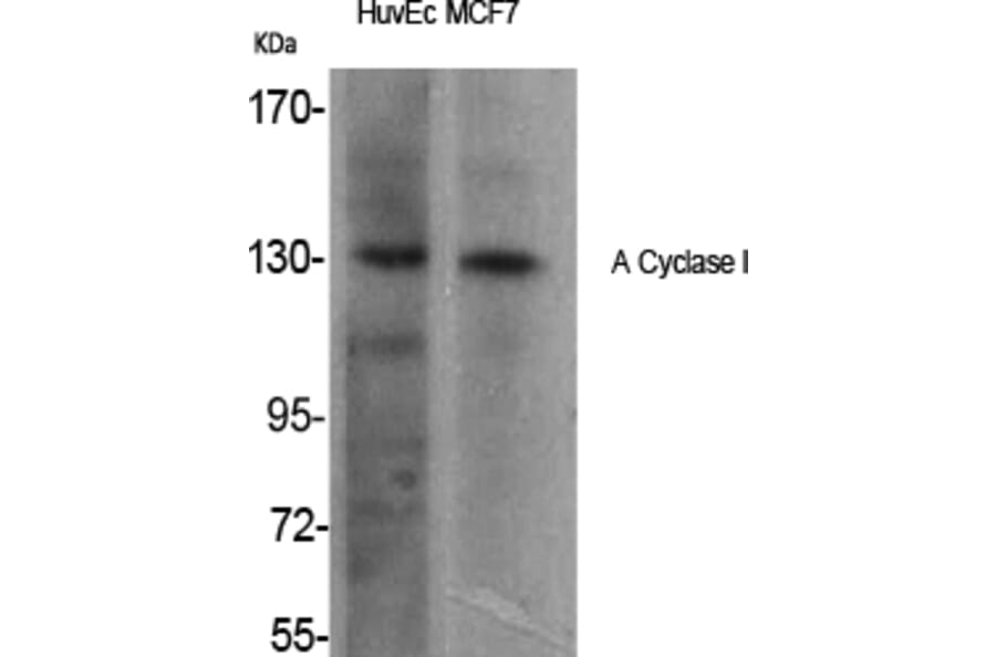 Western Blot - Anti-ADCY1 Antibody (C12031) - Antibodies.com