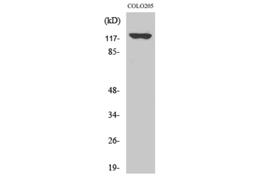 Western Blot - Anti-ADCY1 Antibody (C12031) - Antibodies.com