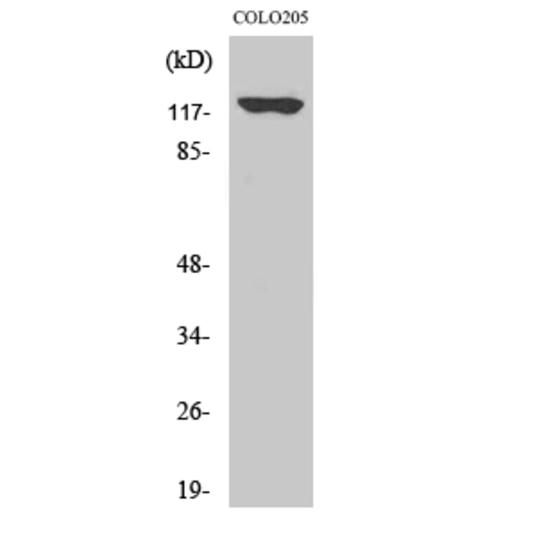 Western Blot - Anti-ADCY1 Antibody (C12031) - Antibodies.com