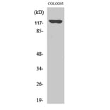 Western Blot - Anti-ADCY1 Antibody (C12031) - Antibodies.com