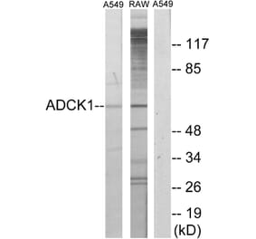 Western Blot - Anti-ADCK1 Antibody (C11274) - Antibodies.com