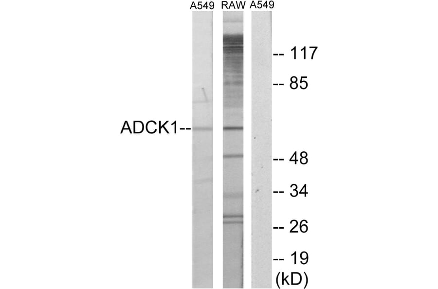 Western Blot - Anti-ADCK1 Antibody (C11274) - Antibodies.com