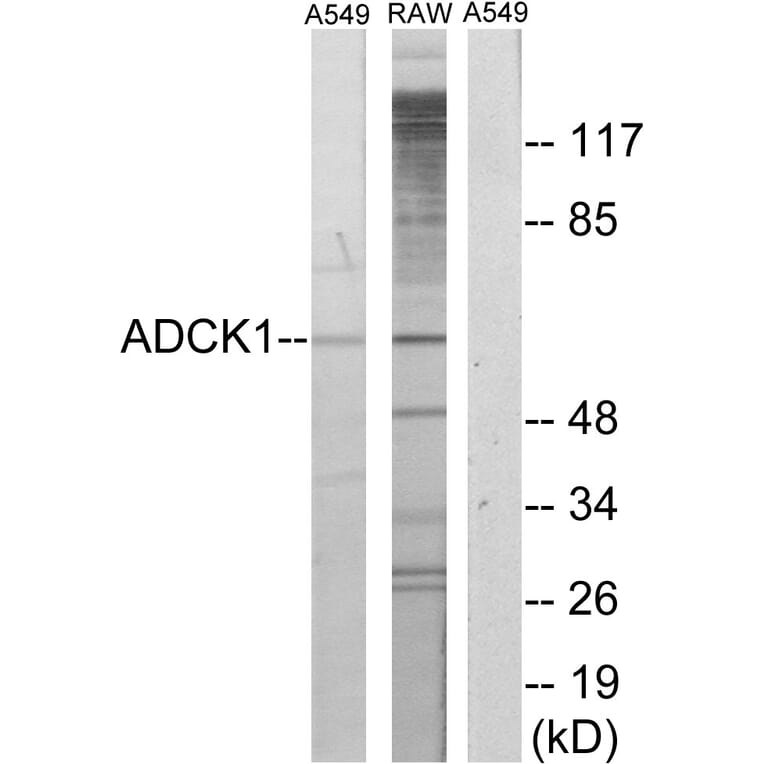 Western Blot - Anti-ADCK1 Antibody (C11274) - Antibodies.com