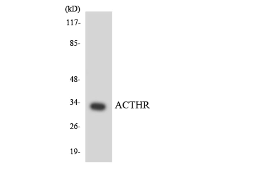 Western Blot - Anti-ACTHR Antibody (R12-2441) - Antibodies.com
