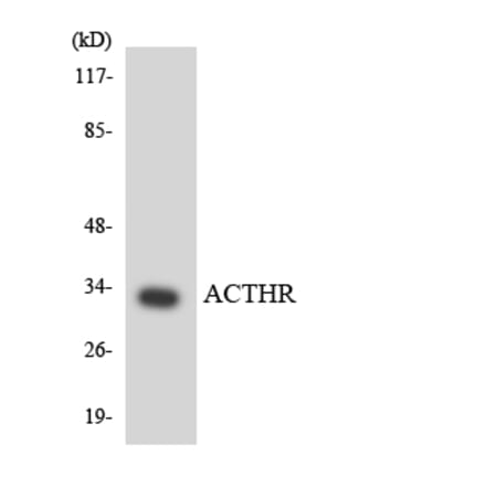 Western Blot - Anti-ACTHR Antibody (R12-2441) - Antibodies.com