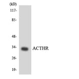 Western Blot - Anti-ACTHR Antibody (R12-2441) - Antibodies.com