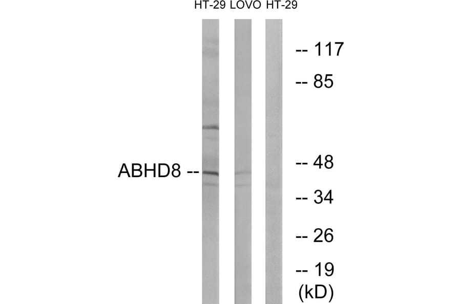 Western Blot - Anti-ABHD8 Antibody (C14220) - Antibodies.com