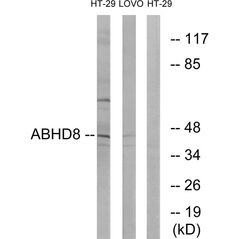 Western Blot - Anti-ABHD8 Antibody (C14220) - Antibodies.com
