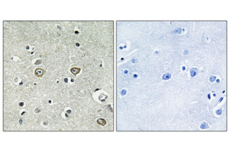 Immunohistochemistry - Anti-ABHD8 Antibody (C14220) - Antibodies.com