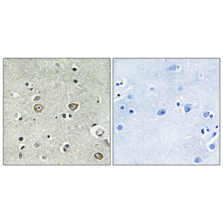 Immunohistochemistry - Anti-ABHD8 Antibody (C14220) - Antibodies.com