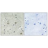 Immunohistochemistry - Anti-ABHD8 Antibody (C14220) - Antibodies.com