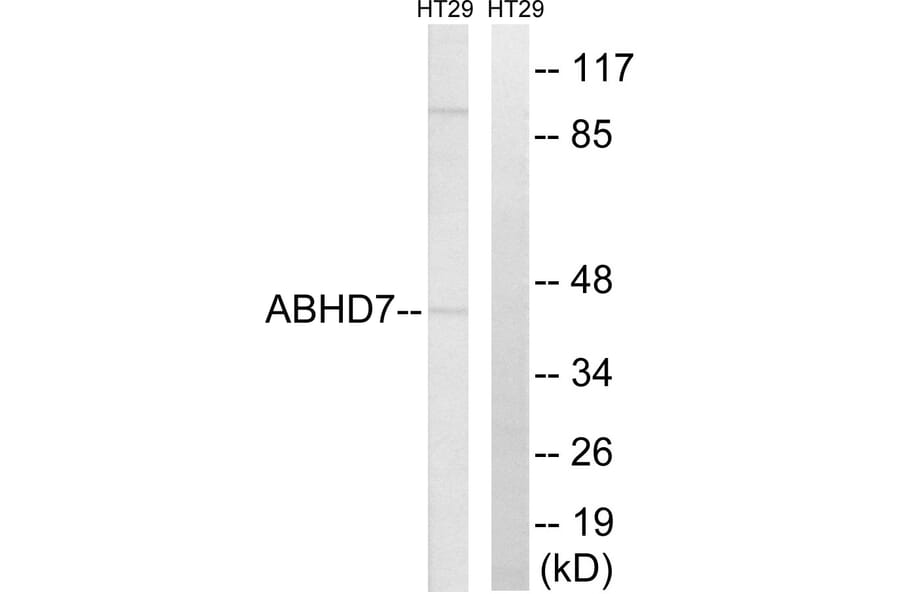 Western Blot - Anti-ABHD7 Antibody (C14219) - Antibodies.com