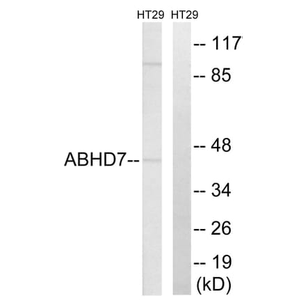 Western Blot - Anti-ABHD7 Antibody (C14219) - Antibodies.com