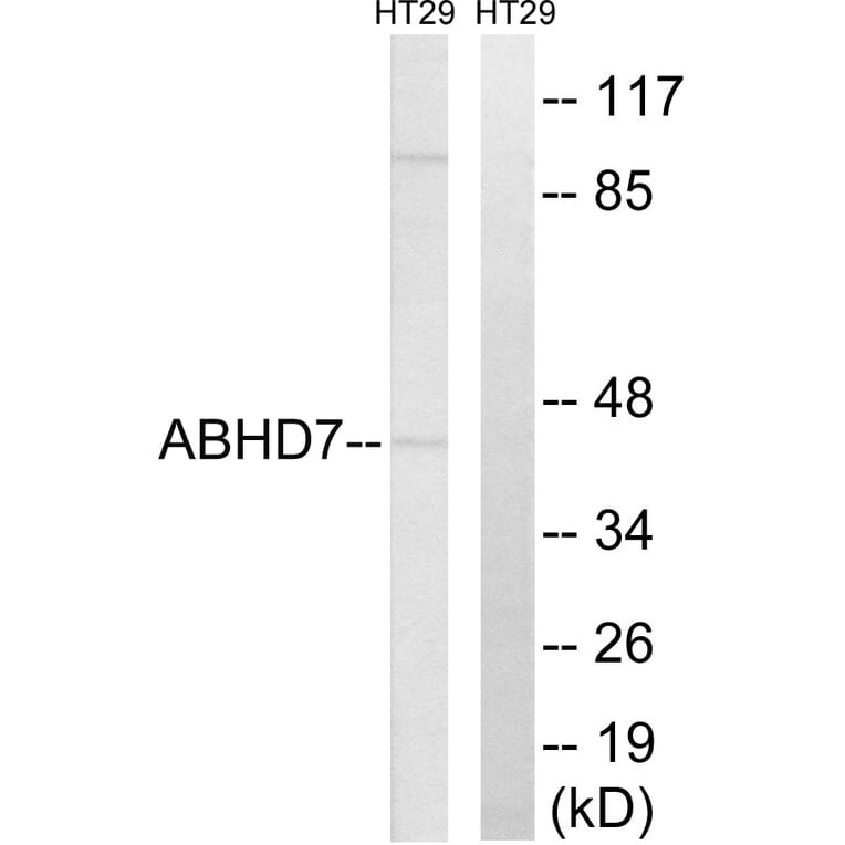 Western Blot - Anti-ABHD7 Antibody (C14219) - Antibodies.com