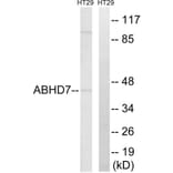 Western Blot - Anti-ABHD7 Antibody (C14219) - Antibodies.com