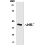 Western Blot - Anti-ABHD7 Antibody (R12-2431) - Antibodies.com